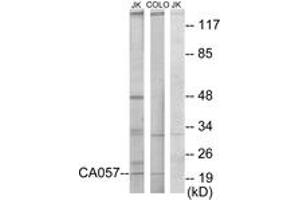 Western blot analysis of extracts from Jurkat/COLO205 cells, using C1orf57 Antibody. (C1orf57 抗体  (AA 141-190))