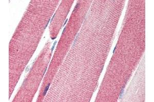 Human Skeletal Muscle (formalin-fixed, paraffin-embedded) stained with LGI4at 5 µg/ml followed by biotinylated goat anti-rabbit IgG secondary antibody, alkaline phosphatase-streptavidin and chromogen. (LGI4 抗体)