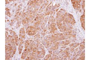 Immunohistochemistry (IHC) image for anti-14-3-3 alpha + beta (YWHAB) (Center) antibody (ABIN2856888)