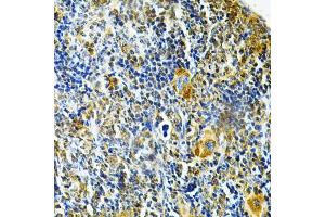 Immunohistochemistry of paraffin-embedded mouse spleen using GLRX Antibody (ABIN6127980, ABIN6141147, ABIN6141149 and ABIN6220940) at dilution of 1:200 (40x lens). (Glutaredoxin 1 抗体  (AA 1-106))