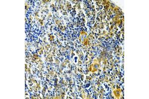 Immunohistochemistry of paraffin-embedded mouse spleen using GLRX Antibody (ABIN6127980, ABIN6141147, ABIN6141149 and ABIN6220940) at dilution of 1:200 (40x lens). (Glutaredoxin 1 抗体  (AA 1-106))