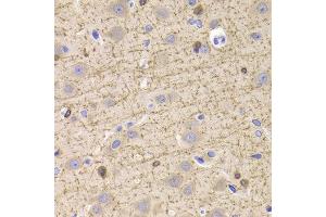 Immunohistochemistry of paraffin-embedded Rat brain using CNP antibody at dilution of 1:100 (x400 lens). (Cnpase 抗体)
