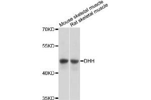 Western blot analysis of extracts of various cell lines, using DHH antibody (ABIN6292005) at 1:3000 dilution.