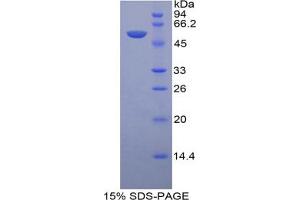 SDS-PAGE analysis of Human LAMP1 Protein. (LAMP1 蛋白)
