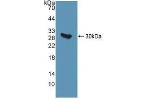 Western blot analysis of recombinant Human QDPR. (QDPR 抗体  (AA 1-244))
