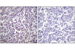 Immunohistochemistry analysis of paraffin-embedded human lymph node tissue, using B-RAF (Ab-601) Antibody. (SNRPE 抗体  (AA 576-625))
