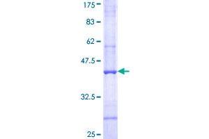 C4B Protein (AA 774-873) (GST tag)