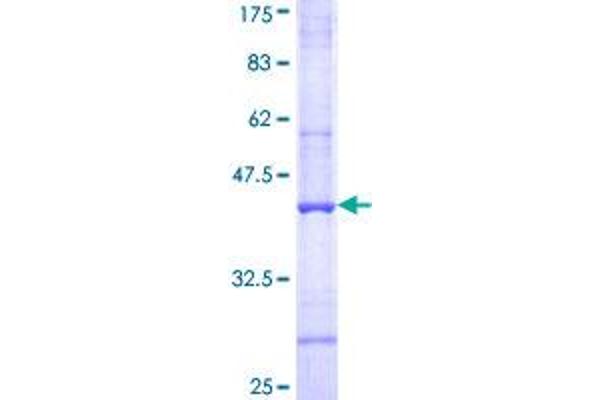C4B Protein (AA 774-873) (GST tag)