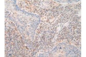 Figure. (PDXK 抗体  (AA 29-253))