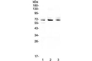 Western blot testing of human 1) A549, 2) SGC-7901 and 3) U-2 OS cell lysate with Bestrophin 1 antibody at 0. (Bestrophin 1 抗体)