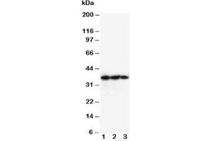Western blot testing of EPO antibody and Lane 1:  Recombinant human protein 10ng;  2: 5ng;  3: 2. (EPO 抗体  (AA 1-166))