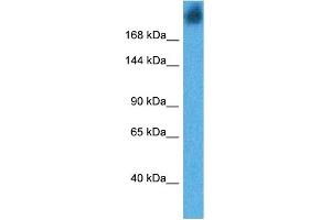 Host:  Rabbit  Target Name:  DMBT1  Sample Tissue:  Human Human Stomach  Antibody Dilution:  1ug/ml (DMBT1 抗体  (N-Term))