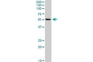 CNDP1 MaxPab rabbit polyclonal antibody. (CNDP1 抗体  (AA 1-507))