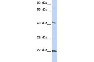 WB Suggested Anti-GJC1 Antibody Titration:  0. (GJC1 抗体  (Middle Region))