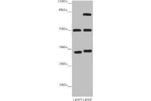 Western blot All lanes: TUBA1B antibody at 12 μg/mL Lane 1: Mouse brain tissue Lane 2: Mouse liver tissue Secondary Goat polyclonal to rabbit IgG at 1/10000 dilution Predicted band size: 51, 38 kDa Observed band size: 51, 34, 75 kDa (TUBA1B 抗体  (AA 29-310))