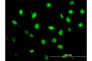 Immunofluorescence of monoclonal antibody to ZFYVE19 on HeLa cell. (ZFYVE19 抗体  (AA 1-396))