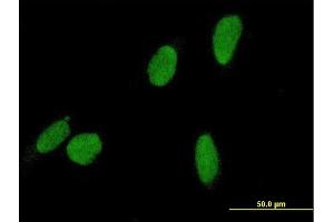 Immunofluorescence of purified MaxPab antibody to DCC1 on HeLa cell. (DSCC1 抗体  (AA 1-393))
