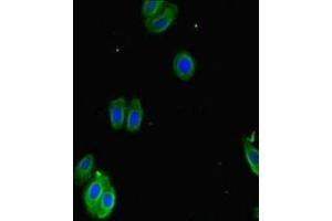 Immunofluorescence (IF) image for anti-SPARC Related Modular Calcium Binding 1 (SMOC1) (AA 277-382) antibody (ABIN7170420)