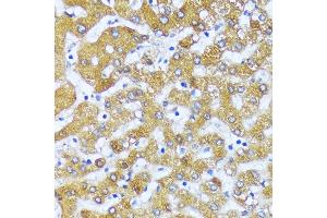 Immunohistochemistry of paraffin-embedded human liver using  antibody (ABIN6130862, ABIN6136444, ABIN6136445 and ABIN6216549) at dilution of 1:100 (40x lens). (Acox2 抗体  (AA 1-150))
