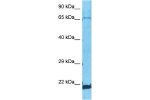Host:  Rabbit  Target Name:  ZNF8  Sample Type:  A549 Whole Cell lysates  Antibody Dilution:  1. (ZNF8 抗体  (C-Term))