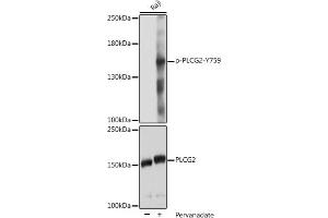 Western blot analysis of extracts of Raji cells, using Phospho-PLC gamma 2 (PLCG2)-Y759 pAb (ABIN7269341) at 1:2000 dilution or PLC gamma 2 (PLCG2) antibody (ABIN3023144, ABIN3023145, ABIN3023146 and ABIN6219411). (Phospholipase C gamma 2 抗体  (pTyr759))