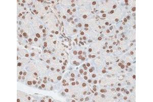Immunohistochemistry of paraffin-embedded Rat pancreas using ZNF177 Polyclonal Antibody at dilution of 1:100 (40x lens). (ZNF177 抗体)