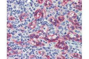 Human spleen; Anti-ZNF71 antibody IHC staining of human spleen. (ZNF71 抗体)