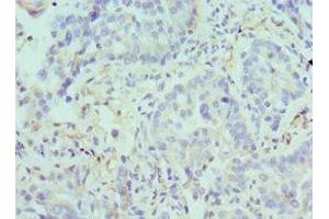 Immunohistochemistry (IHC) image for anti-Arginase, Type II (ARG2) (AA 1-354) antibody (ABIN7144586)