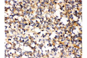 Anti- PAK5 Picoband antibody, IHC(P) IHC(P): Human Glioma Tissue (PAK7 抗体  (N-Term))