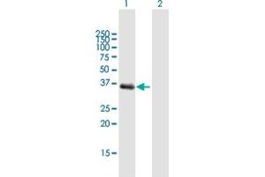 Western Blot analysis of AKR1C1 expression in transfected 293T cell line by AKR1C1 MaxPab polyclonal antibody. (AKR1C1 抗体  (AA 1-323))