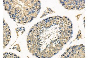 ABIN6263024 and ABIN6278127 at 1/100 staining Mouse testis tissue by IHC-P.