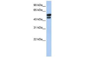 Vimentin antibody used at 1 ug/ml to detect target protein. (Vimentin 抗体  (N-Term))