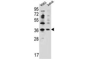anti-Protein Phosphatase 1, Regulatory Subunit 3G (PPP1R3G) (AA 276-307), (C-Term) antibody
