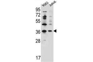 Western blot analysis of PPP1R3G Antibody (C-term) Cat. (PPP1R3G 抗体  (C-Term))
