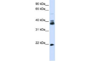 WB Suggested Anti-SYP Antibody Titration:  0. (Synaptophysin 抗体  (N-Term))