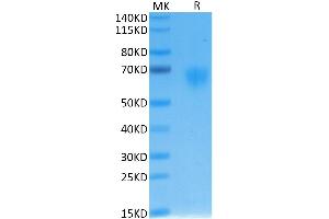 Human IL-2 R gamma on Tris-Bis PAGE under reduced condition. (IL2RG Protein (AA 23-254) (His-Avi Tag))