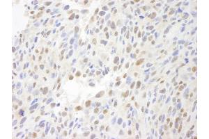 Immunohistochemistry (IHC) image for anti-Chemokine (C-C Motif) Ligand 2 (CCL2) (AA 25-100) antibody (ABIN7448645) (CCL2 抗体  (AA 25-100))