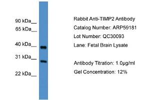WB Suggested Anti-TIMP2  Antibody Titration: 0. (TIMP2 抗体  (Middle Region))