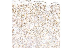 Immunohistochemistry (IHC) image for anti-Fused in Sarcoma (FUS) (AA 400-450) antibody (ABIN7453433) (FUS 抗体  (AA 400-450))