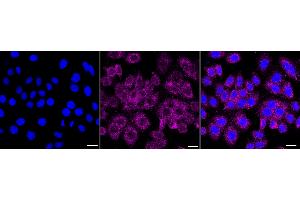 Immunocytochemical staining of HepG2 cells with IGF2BP3 antibody (ABIN7799052), 1:1,000). (Recombinant IGF2BP3 抗体)