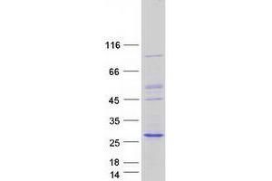 Western Blotting (WB) image for NFKB Inhibitor Interacting Ras-Like 2 (NKIRAS2) (Transcript Variant 1) protein (Myc-DYKDDDDK Tag) (ABIN2727348)