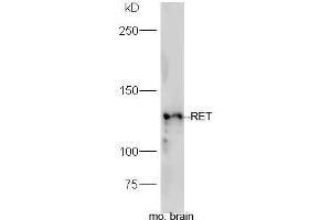 Mouse brain lysates probed with Rabbit Anti-RET Polyclonal Antibody, Unconjugated (ABIN2559573) at 1:300 in 4˚C. (Ret Proto-Oncogene 抗体  (AA 501-600))