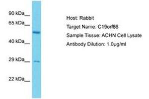 Image no. 1 for anti-Chromosome 19 Open Reading Frame 66 (C19ORF66) (AA 35-84) antibody (ABIN6750629) (C19ORF66 抗体  (AA 35-84))