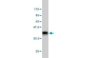 Western Blot detection against Immunogen (36. (GRK6 抗体  (AA 71-170))
