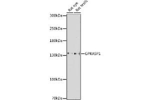Western blot analysis of extracts of various cell lines, using GPR antibody (ABIN7267314) at 1:1000 dilution.