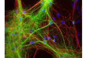 Mixed neuron and glia cultures stained with ABIN1580433 (green), and RPCA- NF-H rabbit antibody to neurofilament NF-H (red) and DNA (blue). (MAP2 抗体)