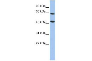 WB Suggested Anti-FOXJ3 Antibody Titration:  0. (FOXJ3 抗体  (Middle Region))