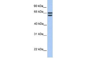 CDYL2 antibody used at 1 ug/ml to detect target protein. (CDYL2 抗体  (N-Term))