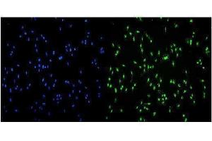 IF analysis of Transketolase/TKT using anti-Transketolase/TKT antibody (ABIN7598959).