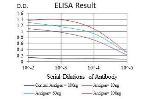 Black line: Control Antigen (100 ng), Purple line: Antigen(10 ng), Blue line: Antigen (50 ng), Red line: Antigen (100 ng), (BPIFB1 抗体)